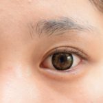 目元の若返り